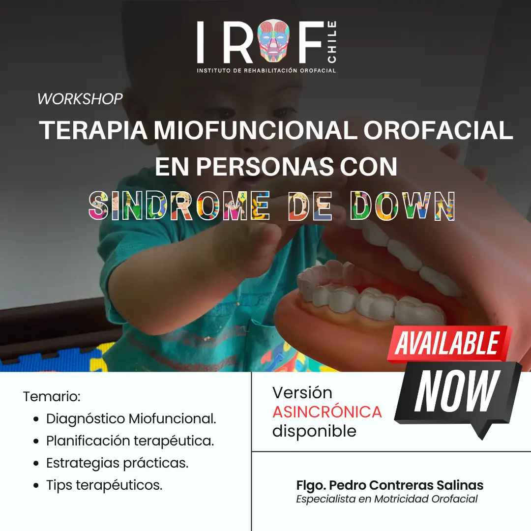 Terapia Miofuncional en Personas con Síndrome de Down